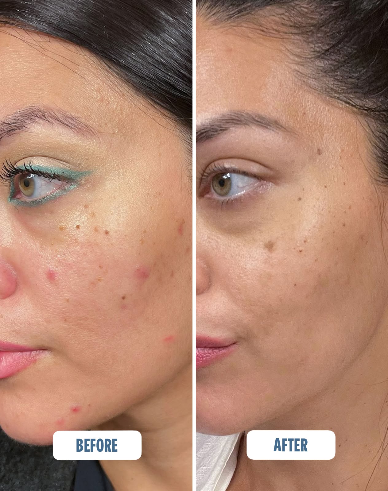 Real results: before and after with Mighty Mist.