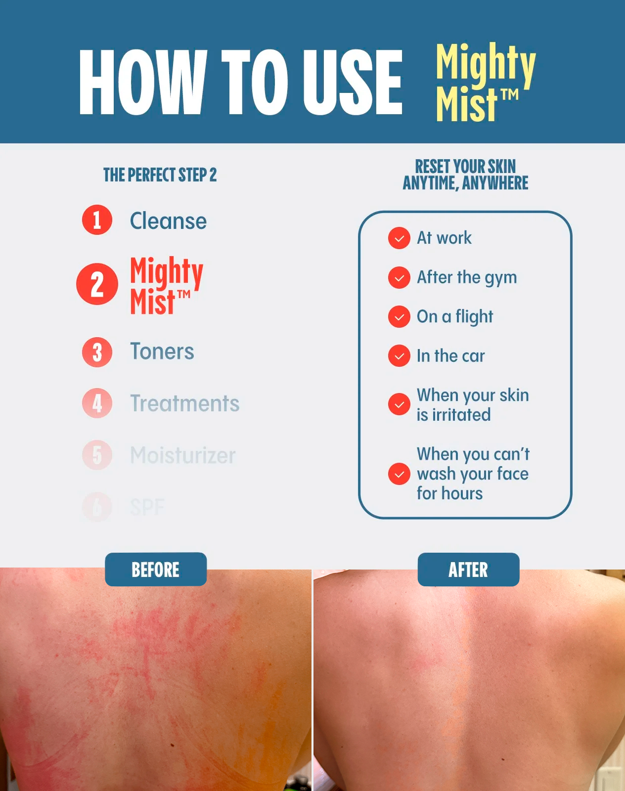 How to use Mighty Mist.
